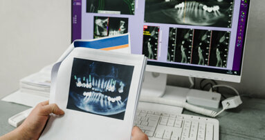 Big data could mean better outcomes for implantology