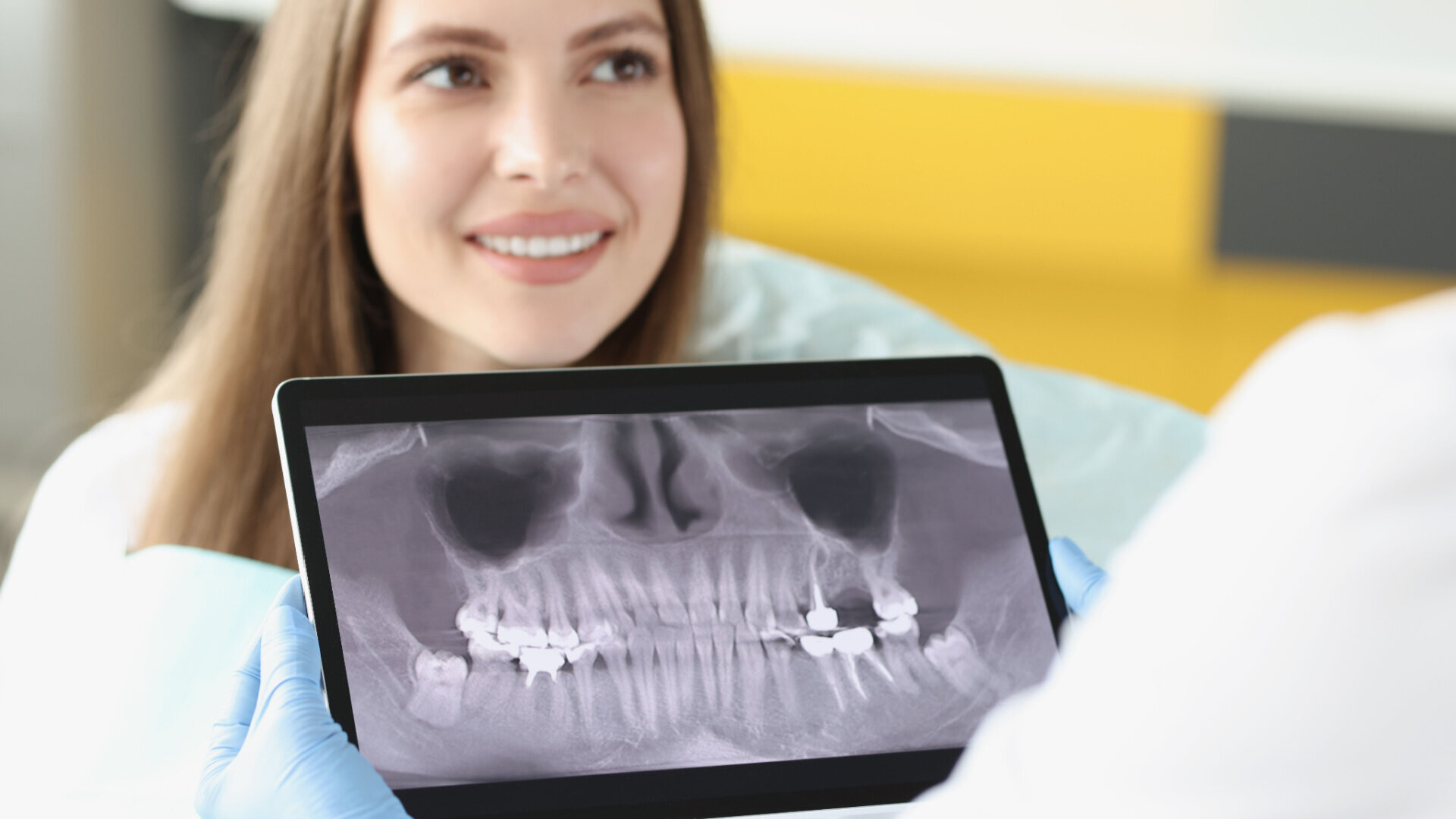 Le chaînon manquant