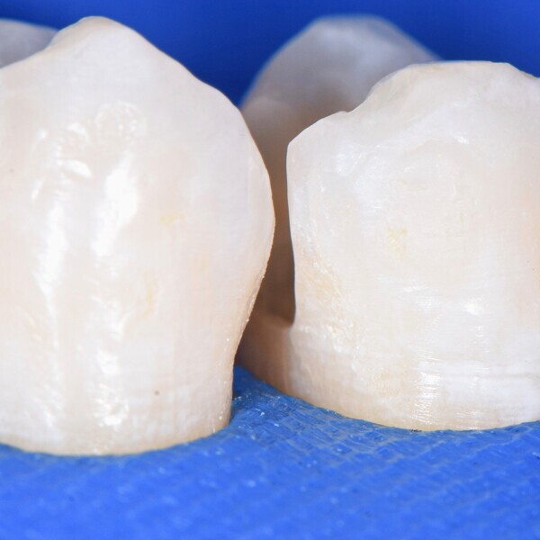 (image: Directa Dental)