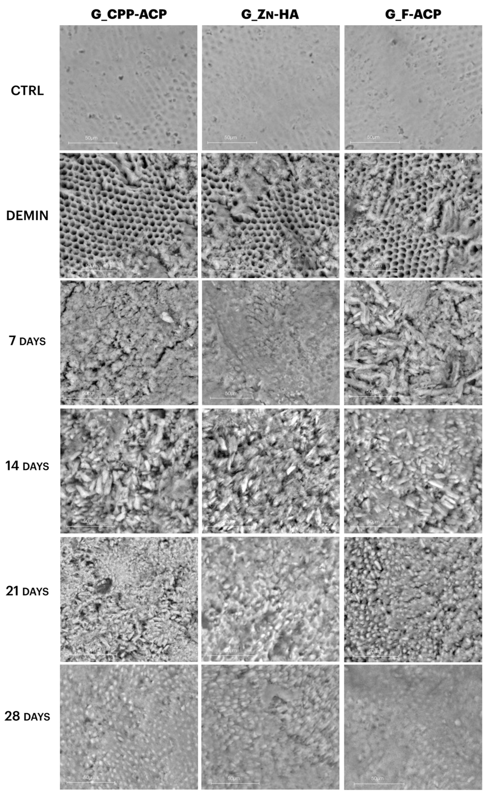 Representative scanning electron micrographs of enamel surfaces showing sound enamel, demineralised enamel and enamel treated with casein phosphopeptide-amorphous calcium phosphate (CPP-ACP), zinc hydroxyapatite (Zn-HA) or fluoridated amorphous calcium phosphate (F-ACP) at seven, 14, 21 and 28 days. (Image: © 2025 “Orilisi et al.”, licensed under “CC BY 4.0”)