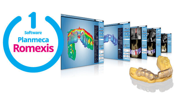 7 semplici passi per un flusso di lavoro completamente digitale in implantologia