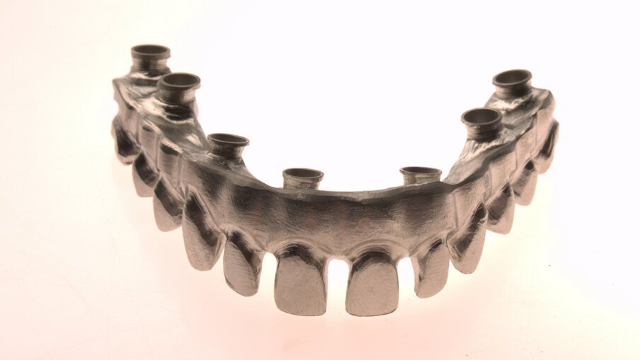 Full-arch rehabilitation with lithium disilicate secondary crowns_5c