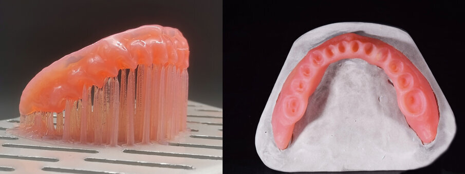 Figs. 14a & b: Printing of the denture base for the mandible (SolFlex 170 HD & V-Print dentbase).