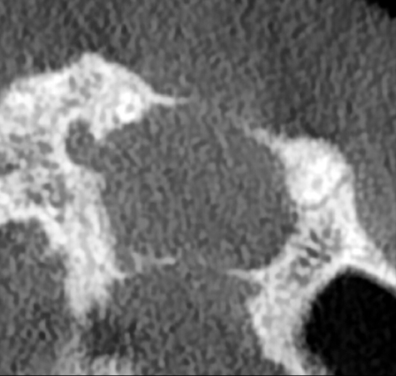 Fig. 2c: Original image.