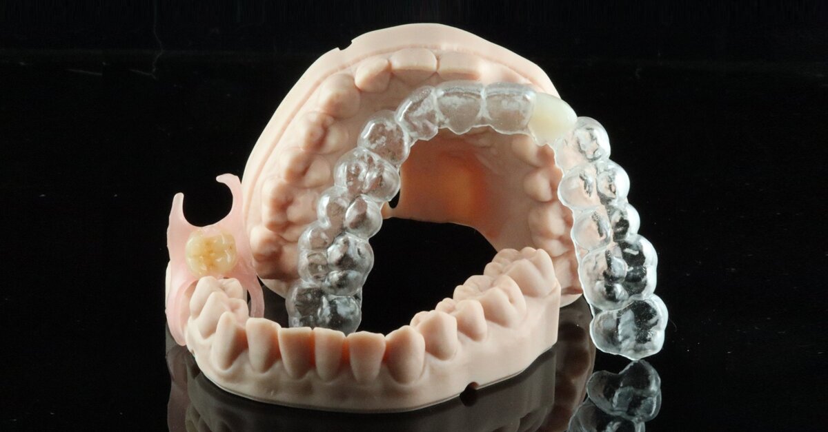 Contemporary provisionalisation with 3D printing: New approaches to familiar clinical challenges