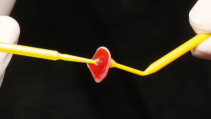 Fig. 13: Conditioning with hydrofluoric acid creates a micro-retentive surface.