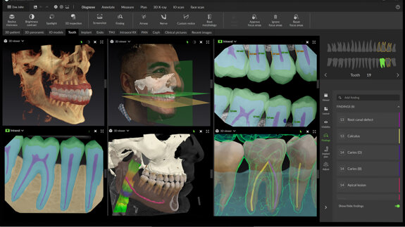 DEXIS sets a new benchmark for digital dentistry with advanced AI and seamless connectivity
