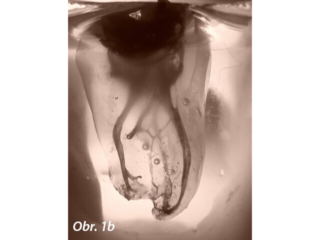 Obr. 1a, b: Složitost anatomie kořenových kanálků je zachycena na těchto projasněných ukázkách horních molárů