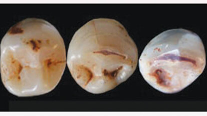 Ancient teeth raise new questions Ancient teeth raise new questions