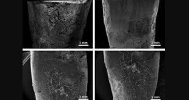 Preservation of root cementum:  A comparative evaluation of power-driven  versus hand instruments