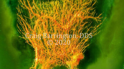 Advances in diaphanization and photography reveal wonders of dental pulp chamber