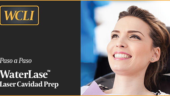 Paso a paso Laser cavidad Prep