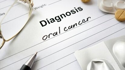 Aumento do câncer oral nos EUA