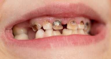 Scotland’s poorest paying the price for dental crisis, says British Dental Association