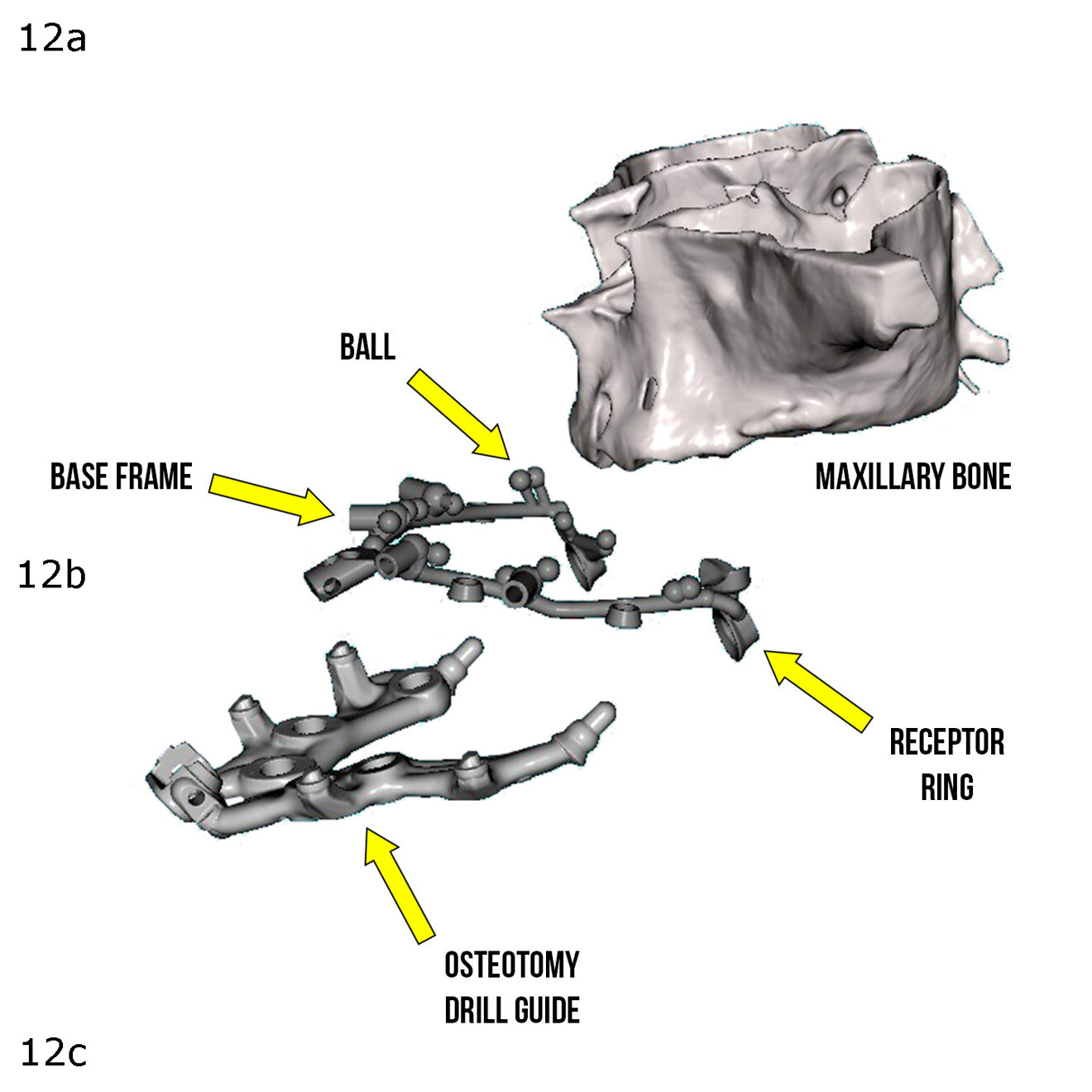 Figs. 12a–c: Schematic representation of the maxillary bone (a), base frame (b) and osteotomy drill guide (c), illustrating the ballpoint contacts and posterior receptor rings.