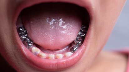 Beyond the clinic: FDIWDC26 sessions place oral health in a wider policy context