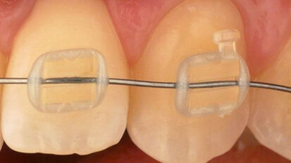 Spaanse onderzoekers lanceren nieuwe generatie onzichtbare slotjes