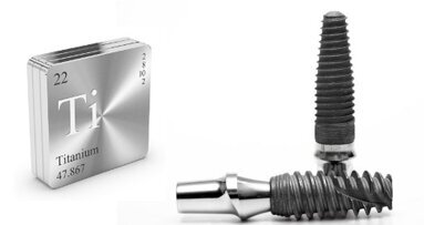 Les implants en titane peuvent comporter un risque de corrosion