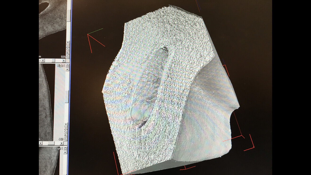 A digital model being prepared for a virtual endoscopy.