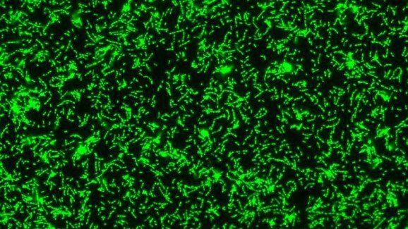 Le mucine salivari svolgono un ruolo attivo nella lotta contro la carie