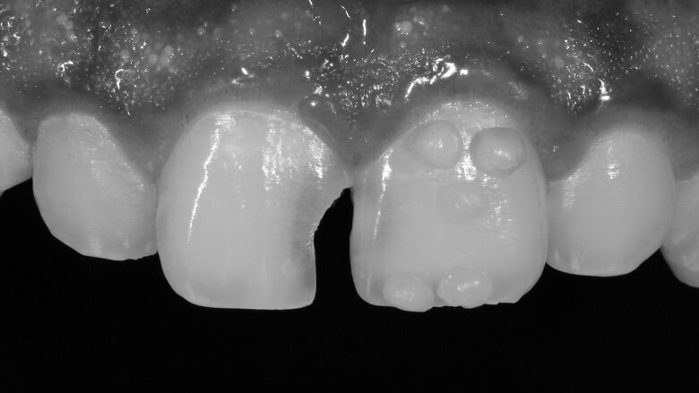 Fig 5: Monochrome image to depict value