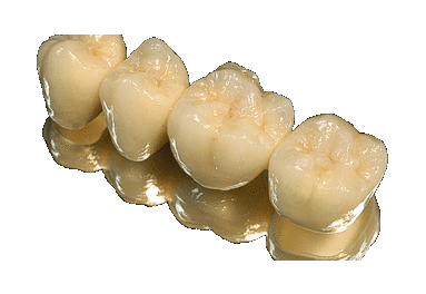 Είναι αποδοτική η τεχνολογία CAD/CAM;