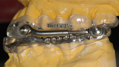 Apnoe- und Protusionsschienen helfen Schnarchern