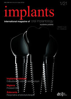 implants Poland No. 1, 2021