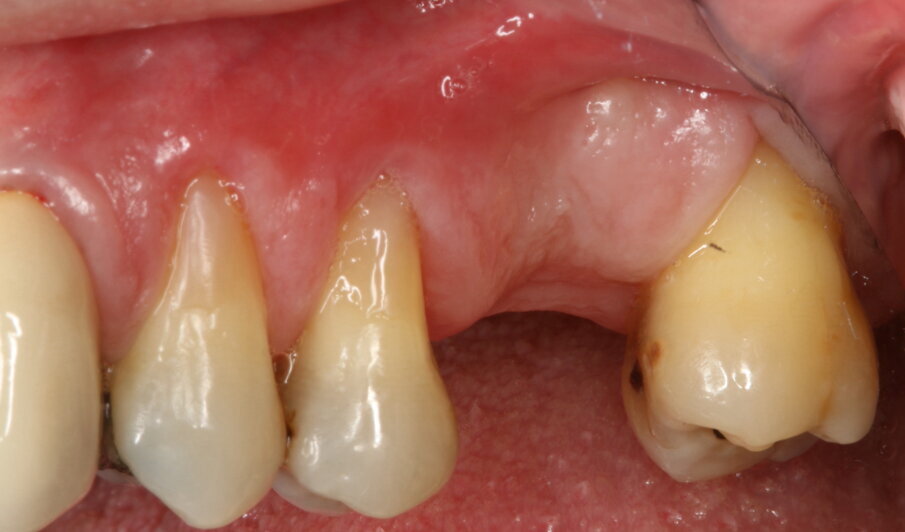 Fig. 1_Caso clinico inziale.
