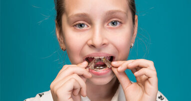 Studie belegt Entstehung von Zahnfehlstellungen im Kindesalter