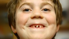 Bijna één op de vijf kinderen niet naar tandarts