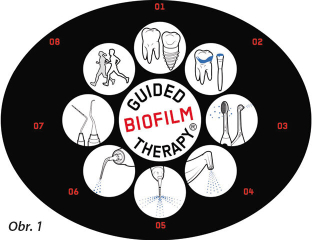 Guided Biofilm Therapy protocol