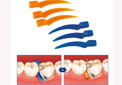 Curvy: 3-D shaped anatomical wedges