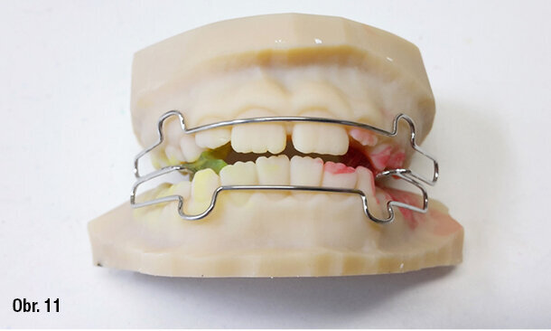 Očištění parní čističkou