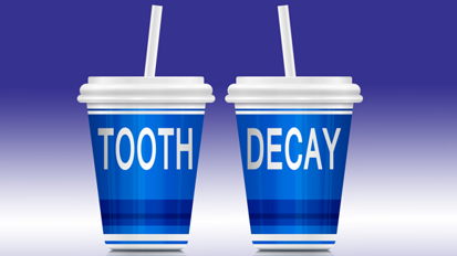 Zahnerosion: Studie entlarvt Zucker und Kohlensäure als größte Übeltäter