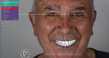 Estetska zona i estetski senzibilitet – želje i mogućnosti - DRUGI DEO