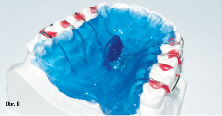 Postup práce s Orthocryl LC