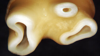 Minimally invasive and biomimetic endodontics: The final evolution?