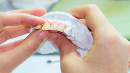 Molti pazienti con perdita dei denti non avrebbero bisogno di protesi