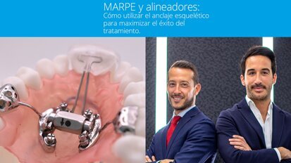 Curso MARPE y alineadores: cómo utilizar el anclaje esquelético