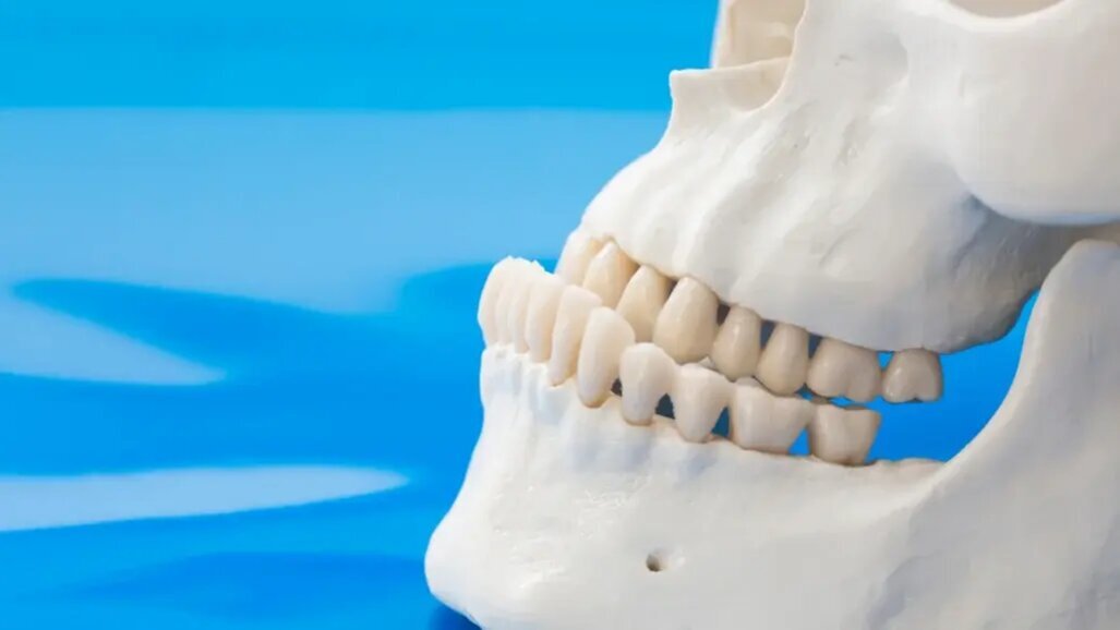 Ортогнатната хирургия за корекция на прогнатия на долната челюст е ефективна за подобряване качеството на живот на пациентите