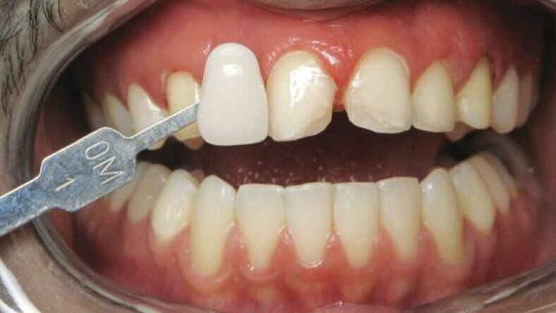 Vous ne pouvez pas toujours obtenir ce que vous voulez (sauf, si vous le demandez clairement !)