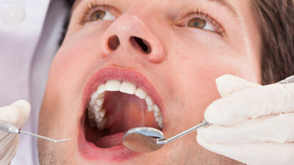 Erhebung: So sieht es im Mund der Schweizer aus