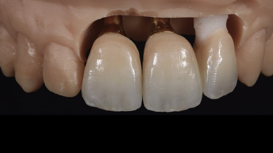 Fig. 11_Risultato finale dopo la cottura di lucidatura, la superfice risulta compatta ma non finalizzata. Si utilizzano gomme e spazzoline con pasta diamantata per migliorarne l’aspetto e raggiungere il grado di lucentezza desiderato.