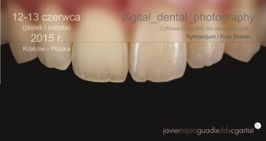 Fotografia i planowanie uśmiechu – kurs dla lekarzy dentystów