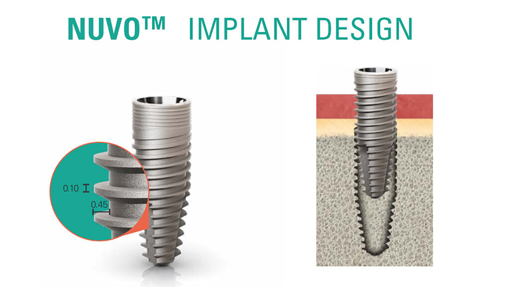 Tapered Implants: Designing original to boost primer stability