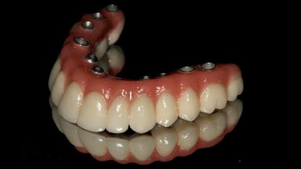 Leczenie implantoprotetyczne atroficznej żuchwy – opis przypadku