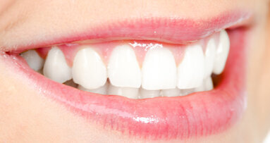 Früherkennung von Zwischenraumkaries mit Infrarotlicht getestet