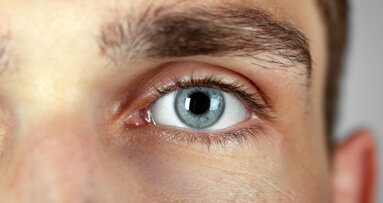 Hypnosis—a useful complementary tool for oral health professionals?