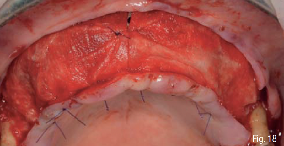 Fig. 18